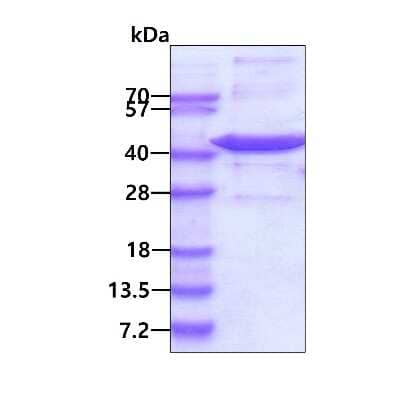 SDS-PAGE: Recombinant Human Spermine synthase His Protein [NBP1-78857]